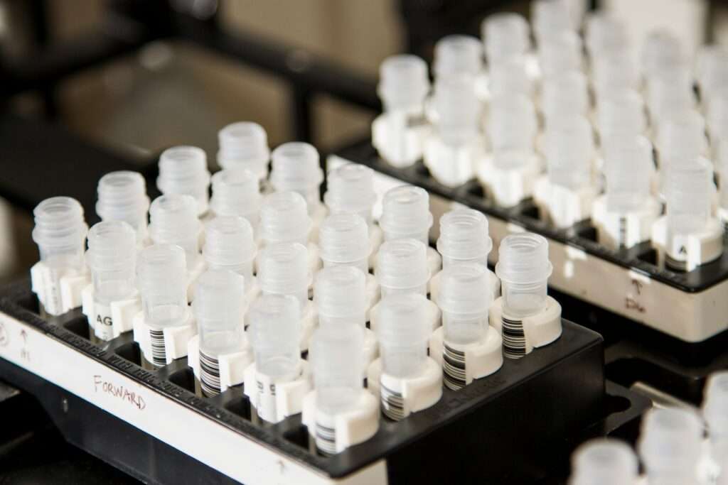 medical culture test samples in tray 